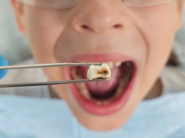 Best Orthodontic Emergency Dentist in Guntersville, AL
